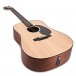 Martin D-10E Road Series Electro Acoustic