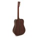 Martin OM-28E LR Baggs Anthem (2025)