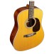 Martin D E Retro Plus Granadillo - body